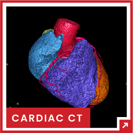 cardiac ct services in tampa