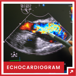 echocardiogram services in tampa