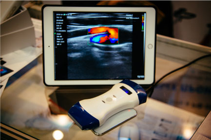 vascular ultrasound tampa