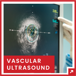 vascular ultrasound services in tampa