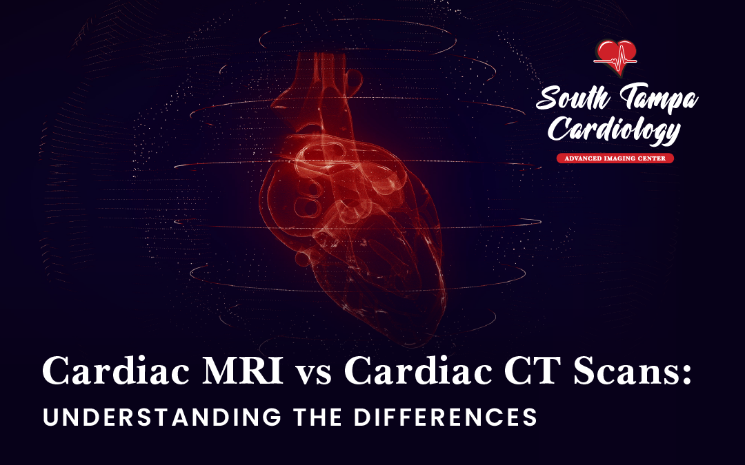 Cardiac MRI vs Cardiac CT Scans: Understanding the Differences