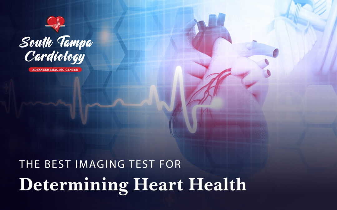 The Best Imaging Test for Determining Heart Health